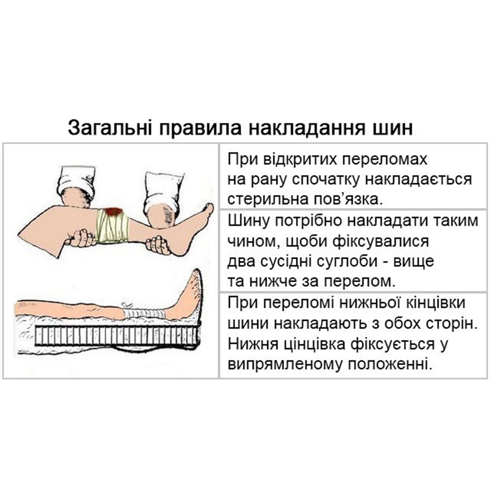 Шина медична фіксуюча металева (по типу Крамера) для ноги, 120 см - Зображення 3