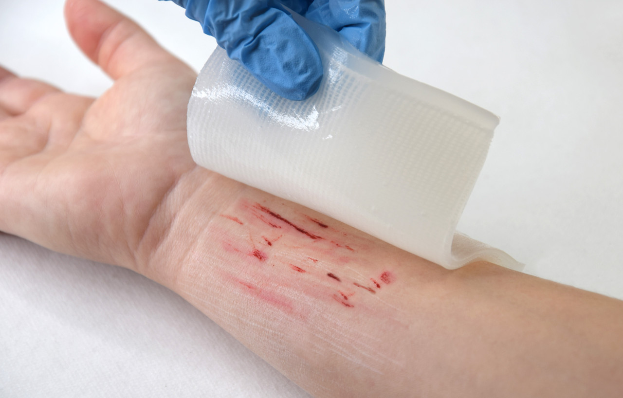 Пов'язка гелева стерильна ранозагоювальна з метилурацилом GELENORM™, 10 х 10 см, №1 - Зображення 3