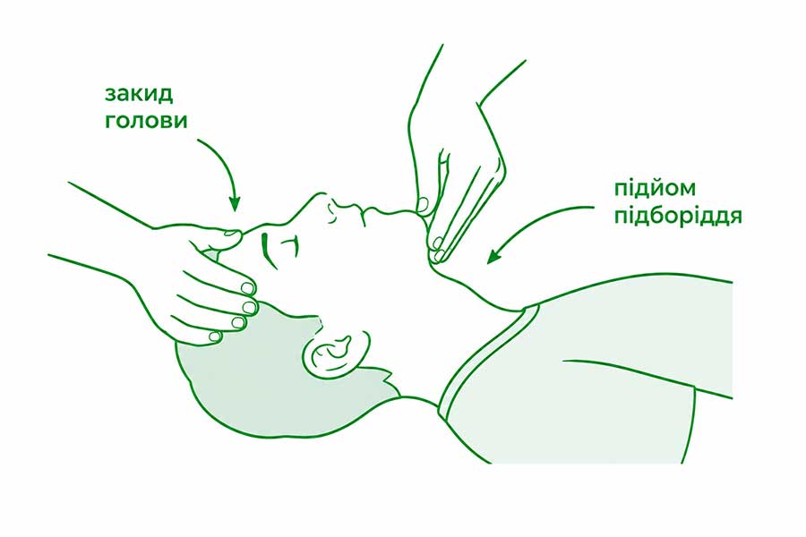 Схема техніки відкриття дихальних шляхів: закид голови і підйом підборіддя - вид збоку 