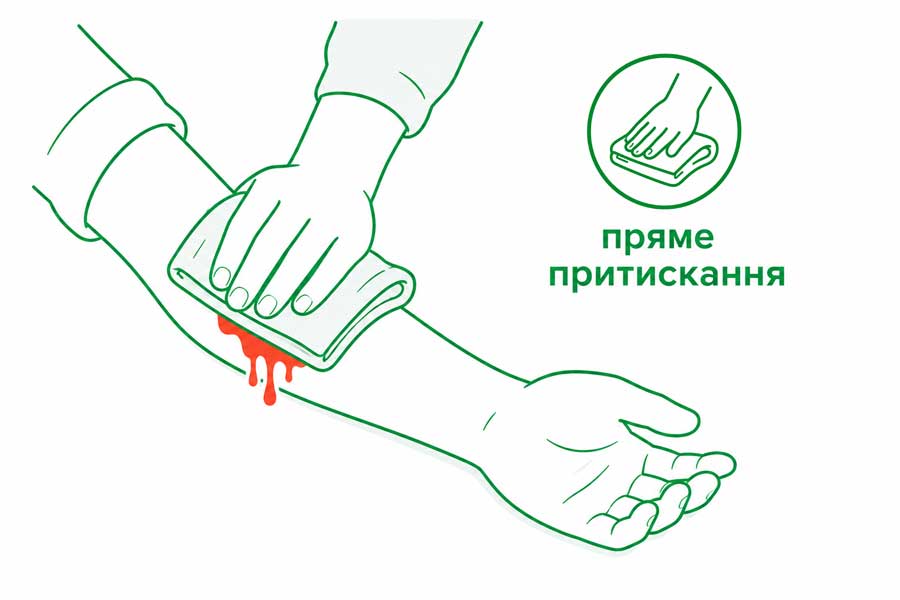 Схема прямого притискання рани: рука накладає складену пов'язку на рану передпліччя — перший метод зупинки кровотечі 