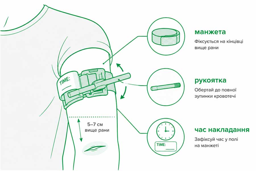 Накладання турнікету CAT на плече: деталі пристрою — манжета, рукоятка windlass, годинний ярлик, стрілки затягування 